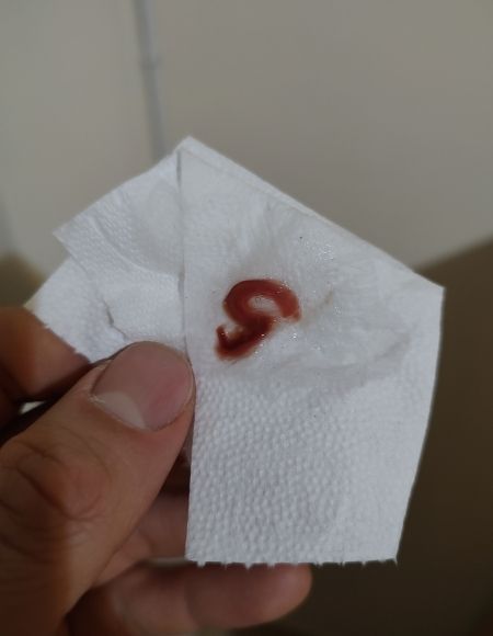 flemas con sangre por covid 19